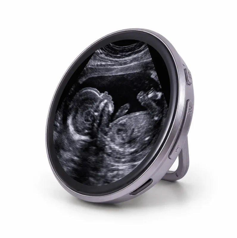 LoveLoop Pin – Hold Your Pregnancy Journey